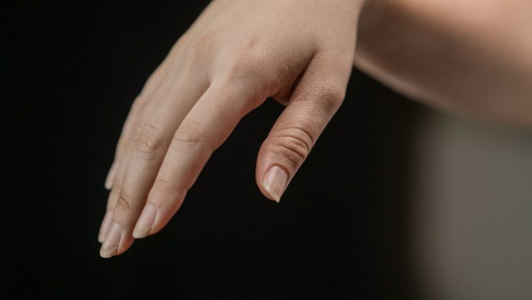 Ongles