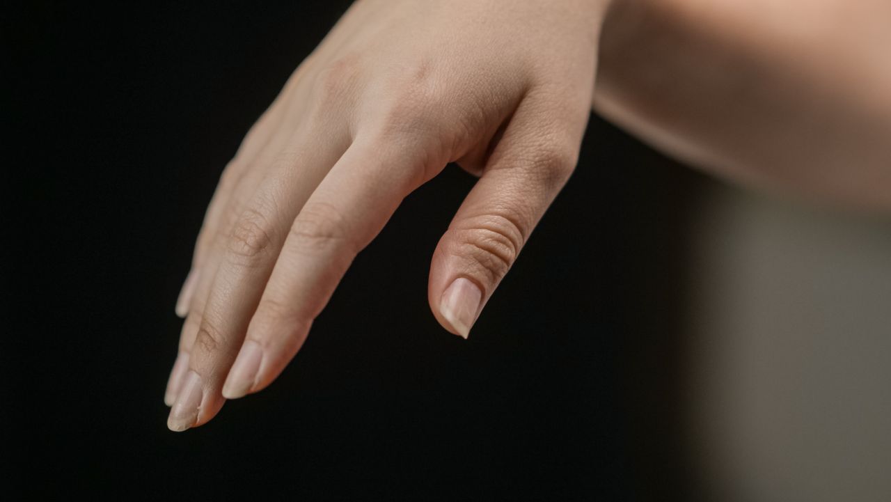 Ongles