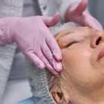 Evelyne Bouix chirurgie esthétique