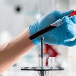 Lipase dans une prise de sang