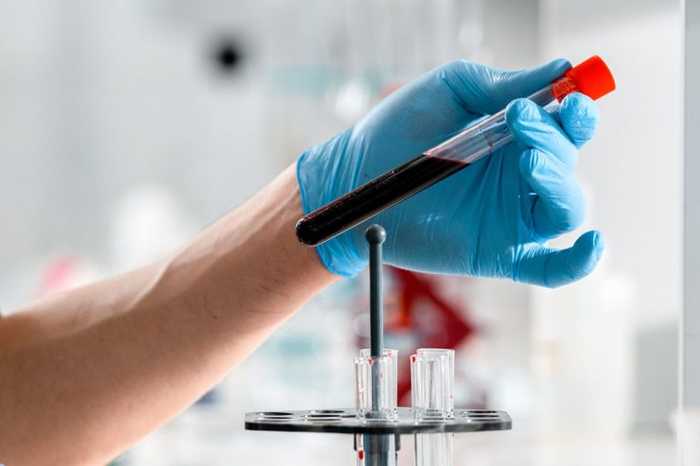 Lipase dans une prise de sang