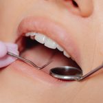 Acte de prophylaxie dentaire
